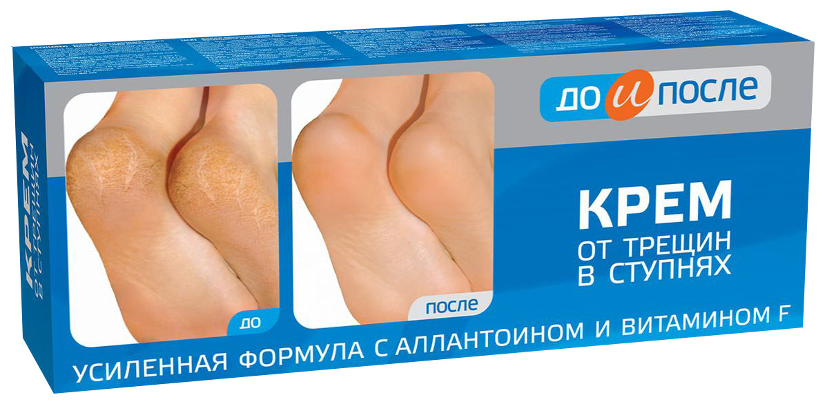 Kem nứt gót chân Kpem Apteka
