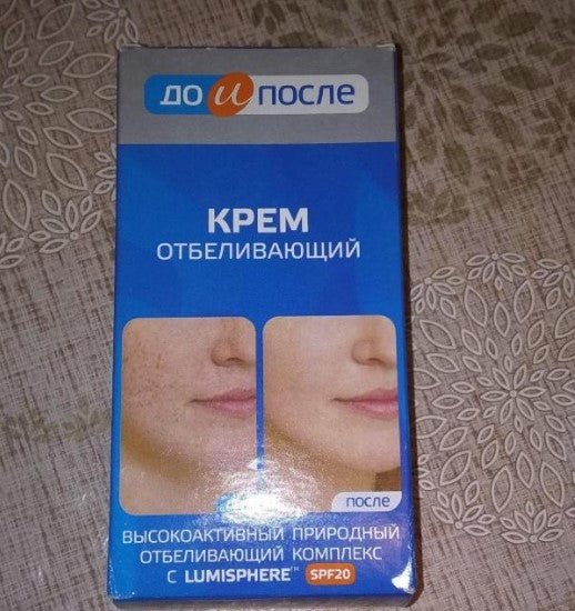 Kem trị nám Kpem