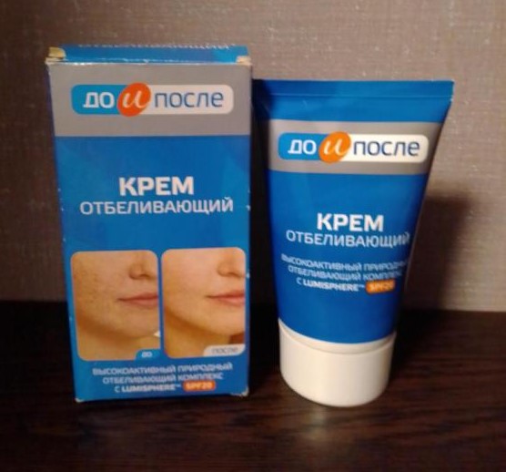 Kem trị nám Kpem